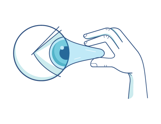 Могут ли контактные линзы прилипнуть к глазам?