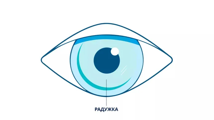Радужка
