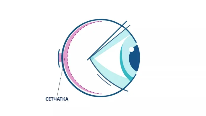 Сетчатка
