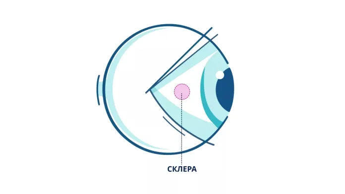 Склера