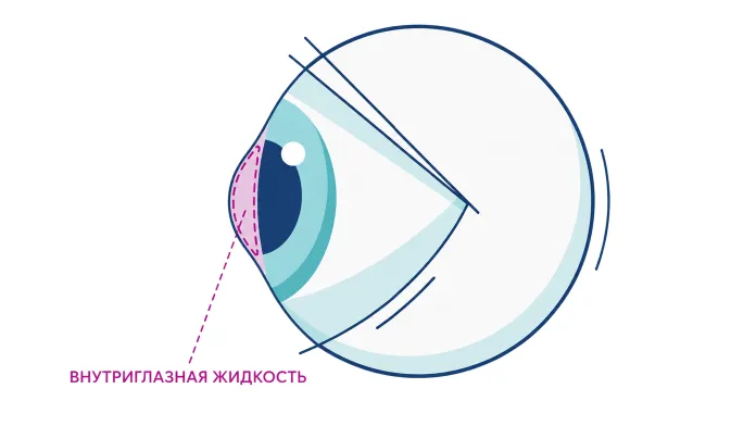 Внутриглазная жидкость и стекловидное тело