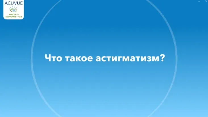 Что такое астигматизм?