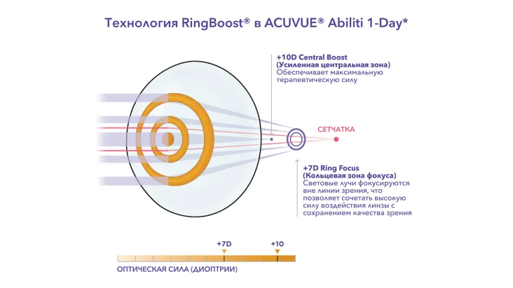 Технология RingBoost в ACUVUE Ability 1-Day